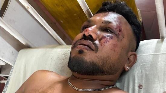 Solo una persona sobrevive entre 242 pasajeros del avión de Air India