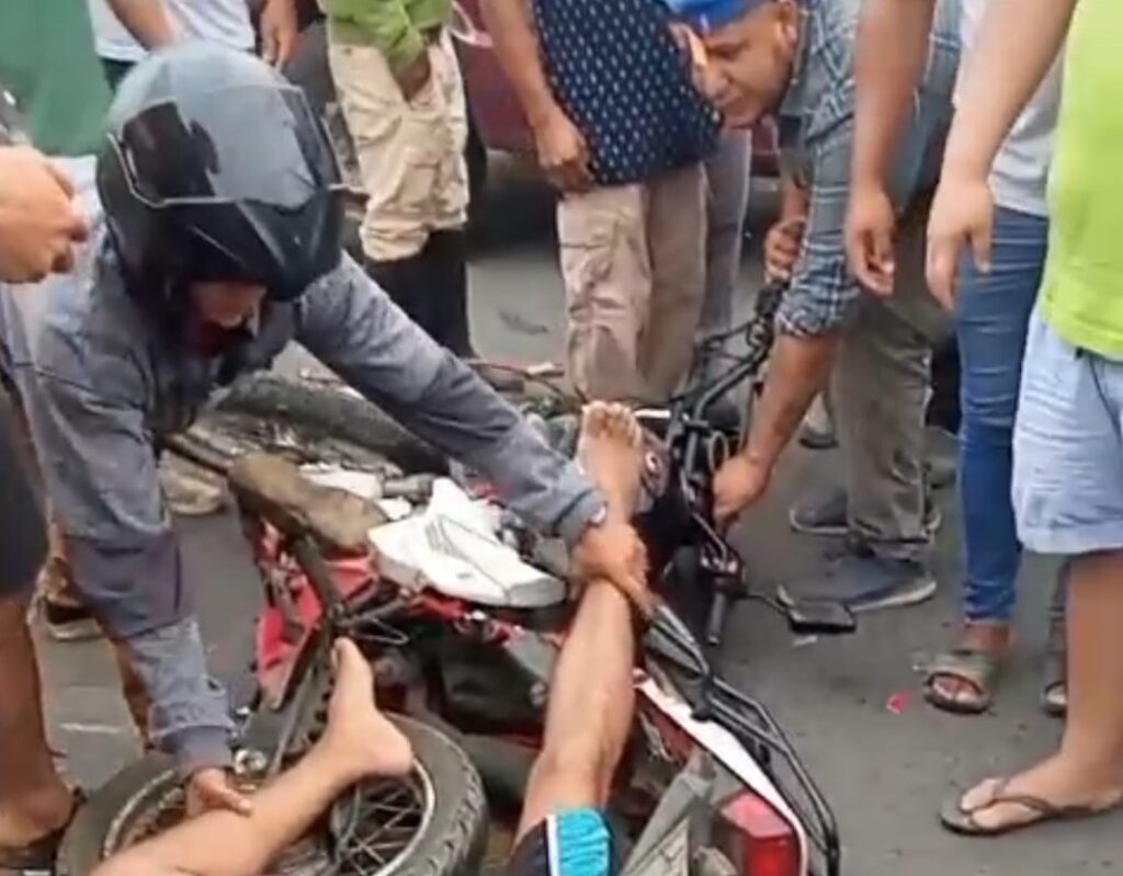 El herido fue auxiliado por quienes circulaban por la zona y moradores del sector.