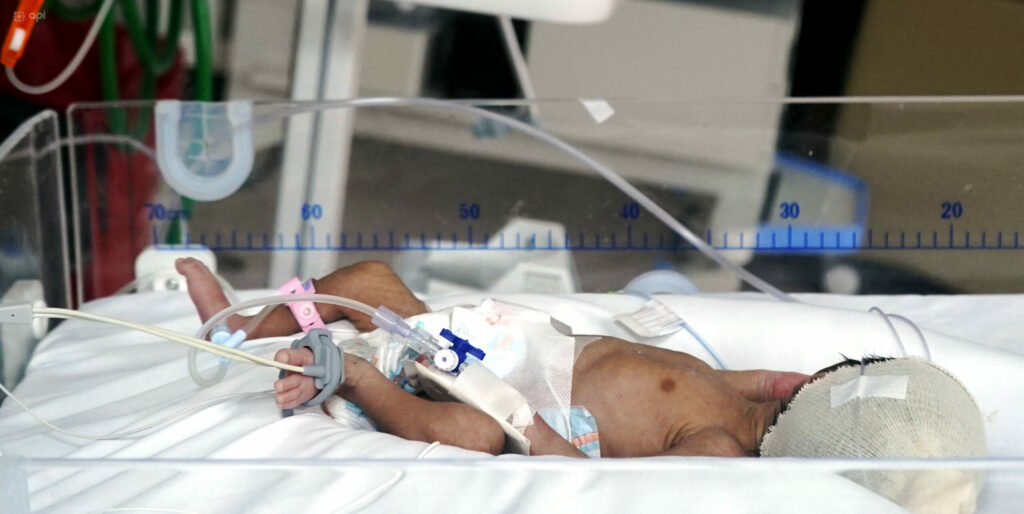 IESS desvincula médicos tras fallecimiento de bebé en hospital de Guayaquil