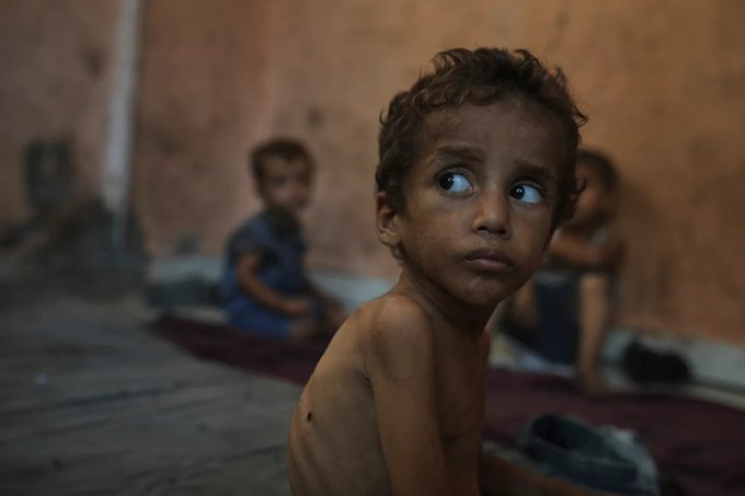 El hambre en Gaza se ensaña con decenas de miles de niños: la malnutrición se triplica en menores de 5 años.
