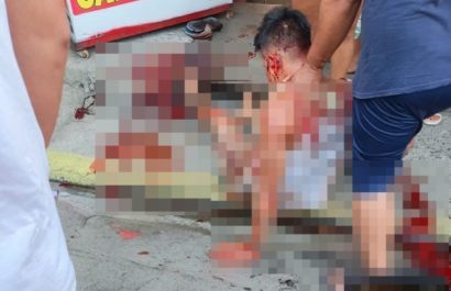 A un hombrelo balearon en la nuca durante un ataque armado registrado la tarde de este viernes 26 de diciembre en los exteriores de un negocio comercial.