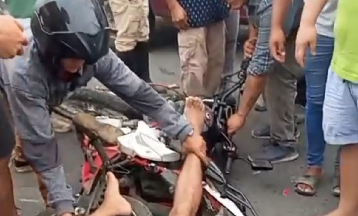 El herido fue auxiliado por quienes circulaban por la zona y moradores del sector.