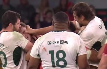 El segunda línea sudafricano Eben Etzebeth podría recibir una suspensión de hasta 208 semanas por hundir el pulgar en el ojo de su rival galés Alex Mann.