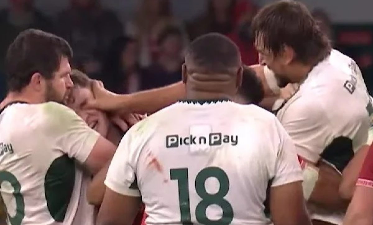 El segunda línea sudafricano Eben Etzebeth podría recibir una suspensión de hasta 208 semanas por hundir el pulgar en el ojo de su rival galés Alex Mann.