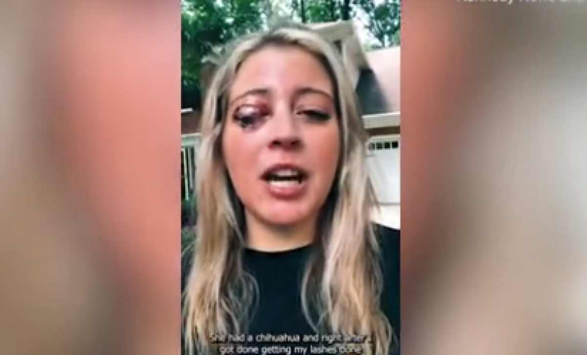 Fue-por-pestanas-postizas-y-volvio-sin-un-parpado