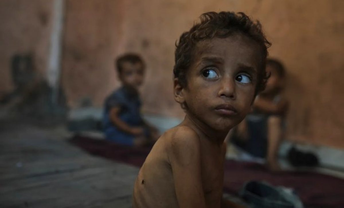 El hambre en Gaza se ensaña con decenas de miles de niños: la malnutrición se triplica en menores de 5 años.