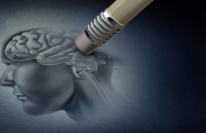 Un fármaco para frenar el Alzheimer es bien tolerado fuera de los ensayos clínicos