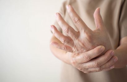 Esclerodermia: enfermedad rara con alto impacto que requiere atención prioritaria
