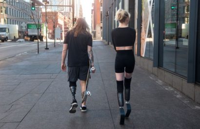 El mapa cerebral permanece intacto tras amputaciones, revela un estudio internacional