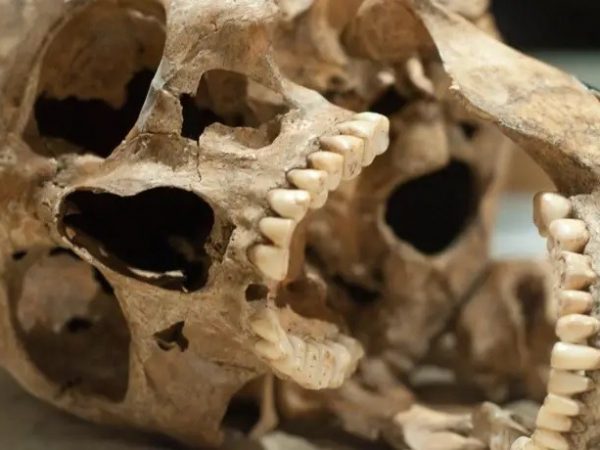 Las zoonosis representan un desafío creciente en la salud global, con eventos como la COVID-19 destacando su relevancia. FOTO: Europa Press.