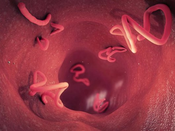 ¿Tienes parásitos y no lo sabes? Estas tres señales podrían confirmarlo