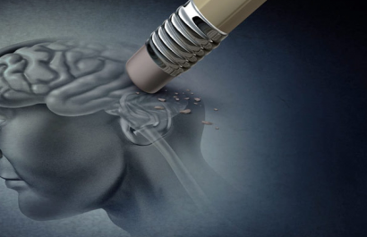 ¿Olvidos frecuentes? Estas podrían ser las primeras señales del Alzheimer