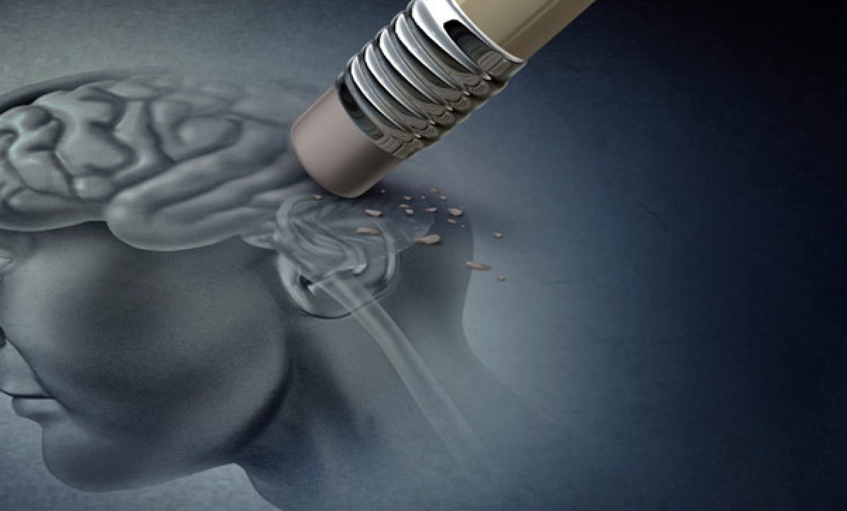 ¿Olvidos frecuentes? Estas podrían ser las primeras señales del Alzheimer